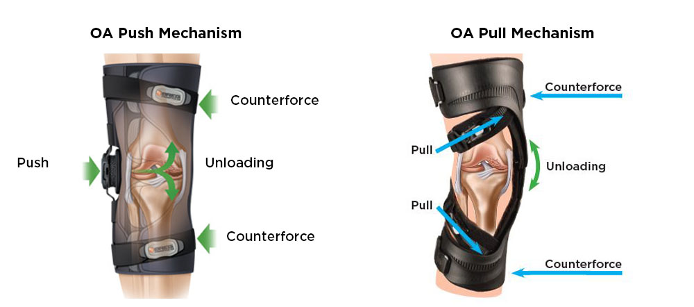 Knee OA Bracing - Osteoarthritis Braces